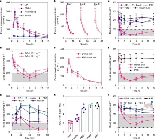 无创给药新突破！浙大团队让糖尿病患者告别打针