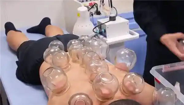 福建舰禁火令引热议，拔罐成唯一可用明火工具？