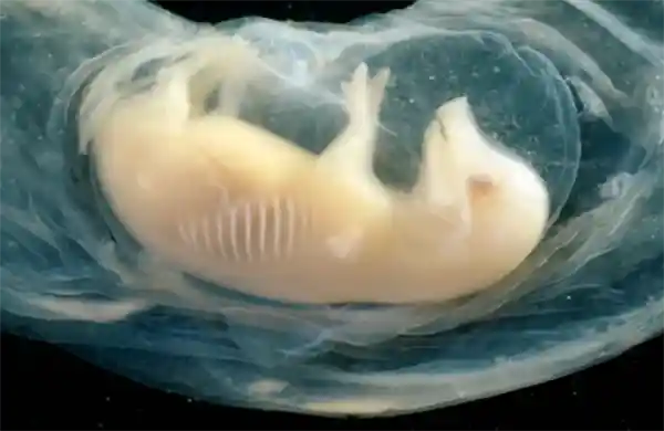 《突破！中国科学家成功孕育人猪嵌合心脏：跨物种生命的21天奇迹》