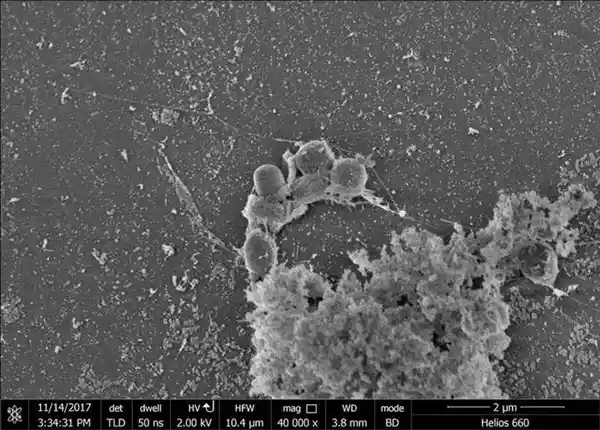 地球上的塑料吃货：为何它们没能拯救世界？