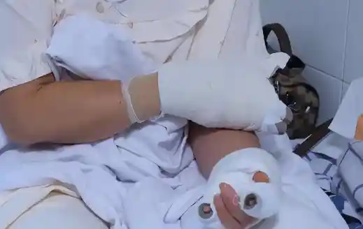 贵阳阿姨捡石意外自燃致重伤引发关注